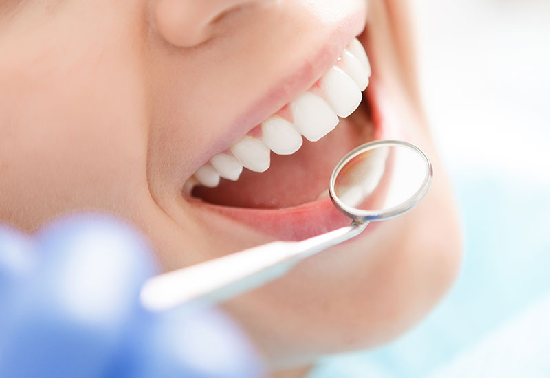 虫歯や歯周病のリスクが低い