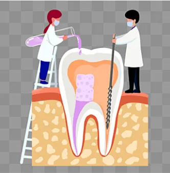 歯内療法を現したイラスト