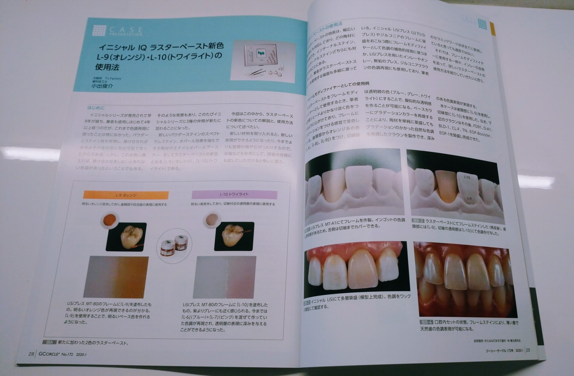 歯科専門誌への掲載写真