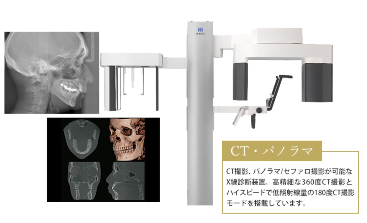 CT,パノラマ